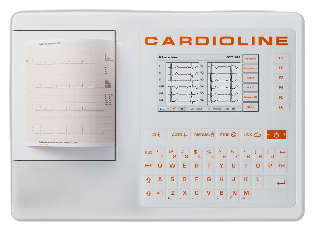 ECG100+