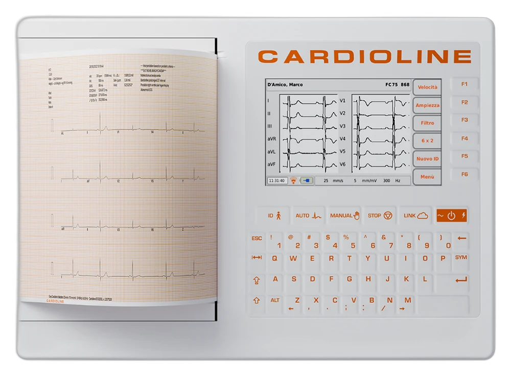 ECG200+