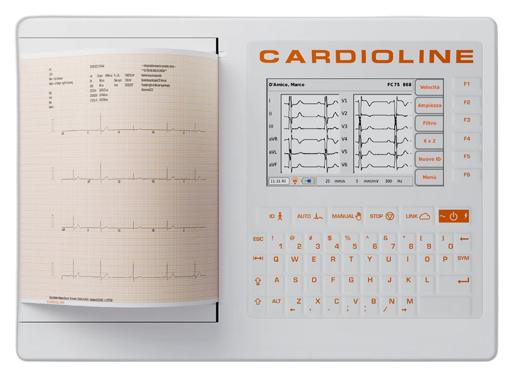 ECG200S