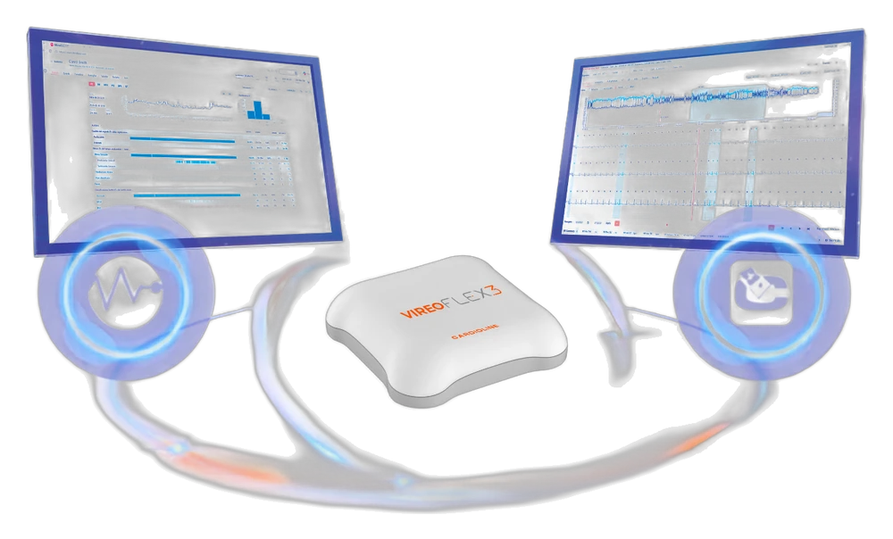 Solução Holter Integrada